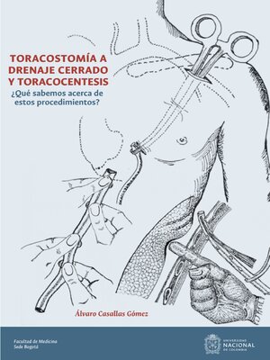 cover image of Toracostomía a drenaje cerrado y toracocentesis